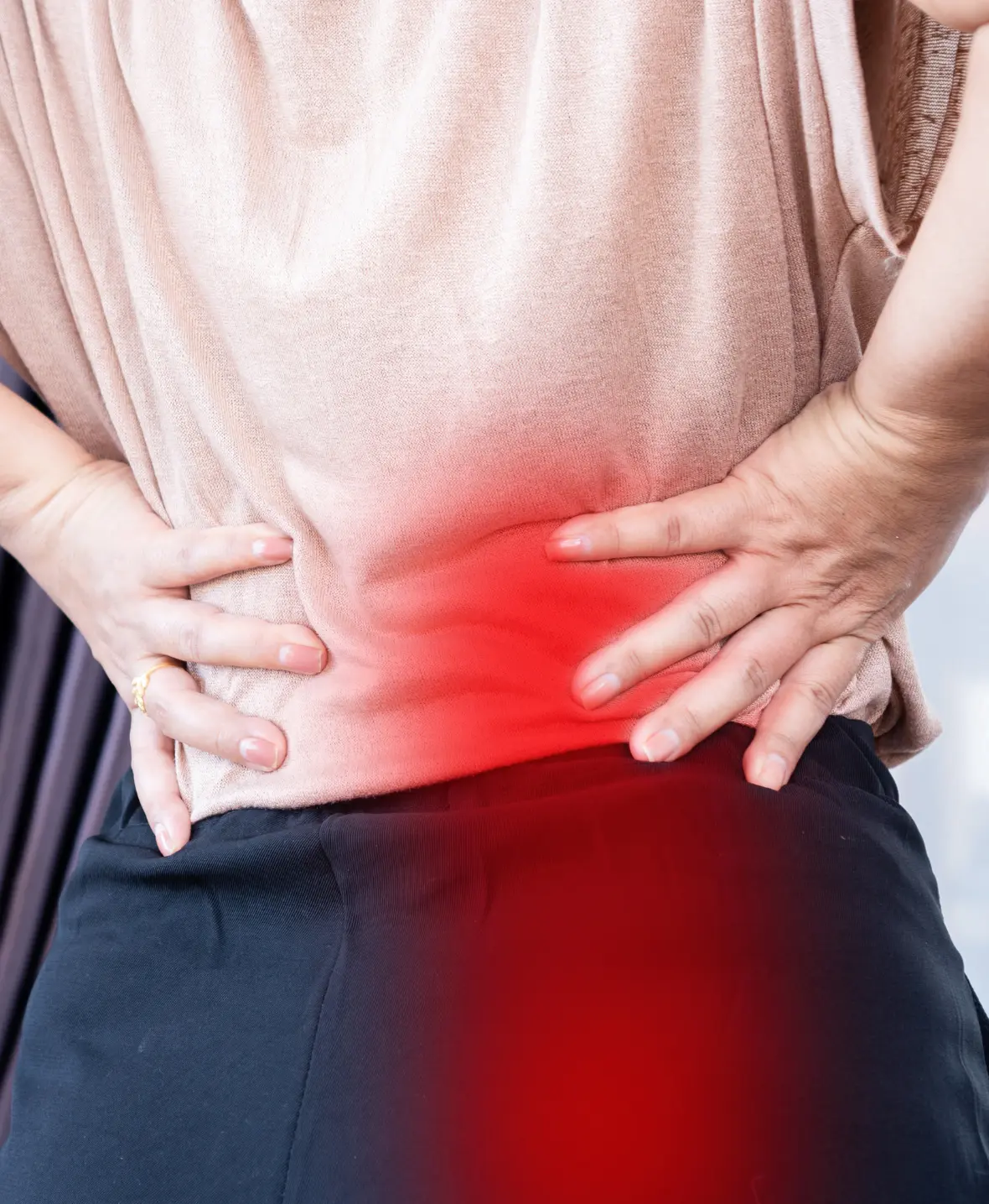 Patient demonstrating flat buttocks due to low body fat, a common cause leading to buttock augmentation surger