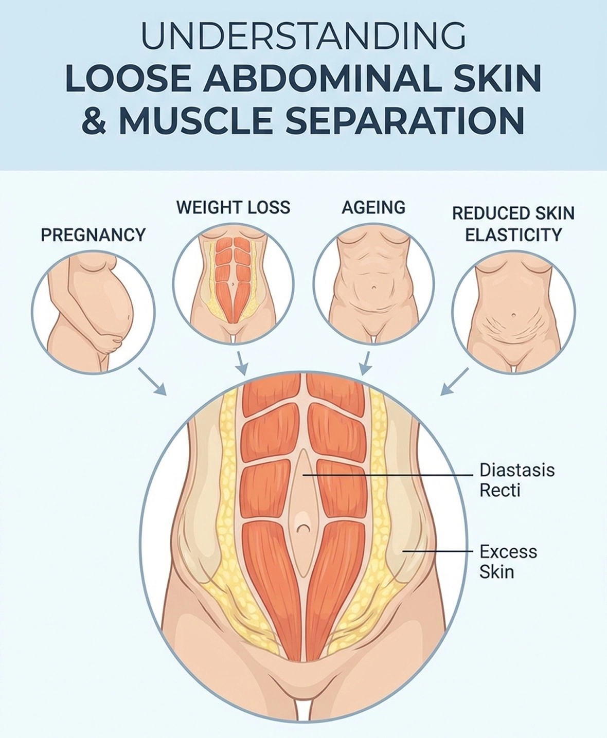 Common causes of loose abdominal skin and muscle separation including pregnancy and weight loss