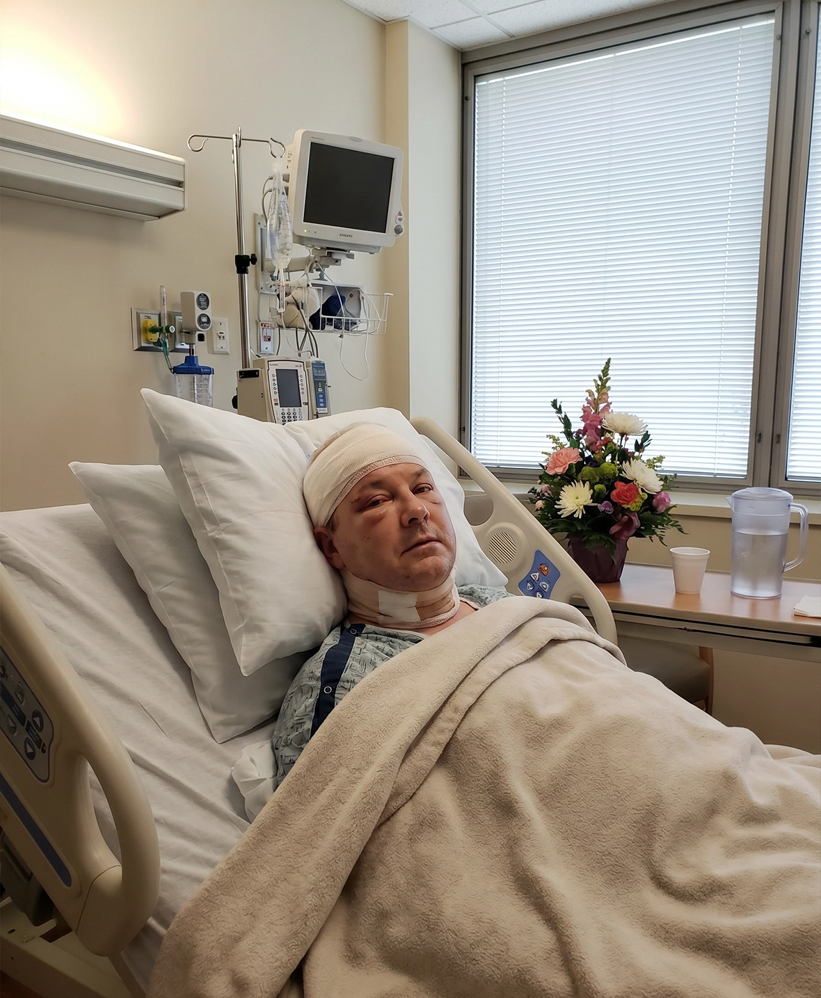 Patient recovering overnight after face lift and neck lift surgery in a private clinic room