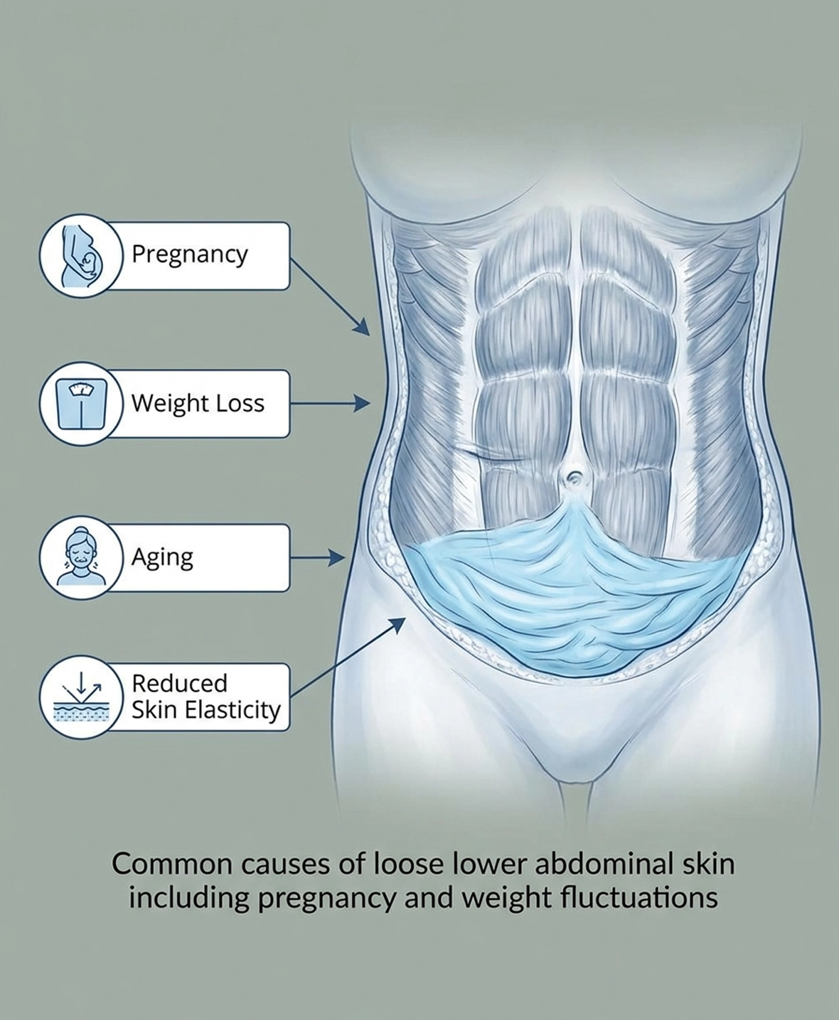 Common causes of loose lower abdominal skin including pregnancy and weight fluctuations
