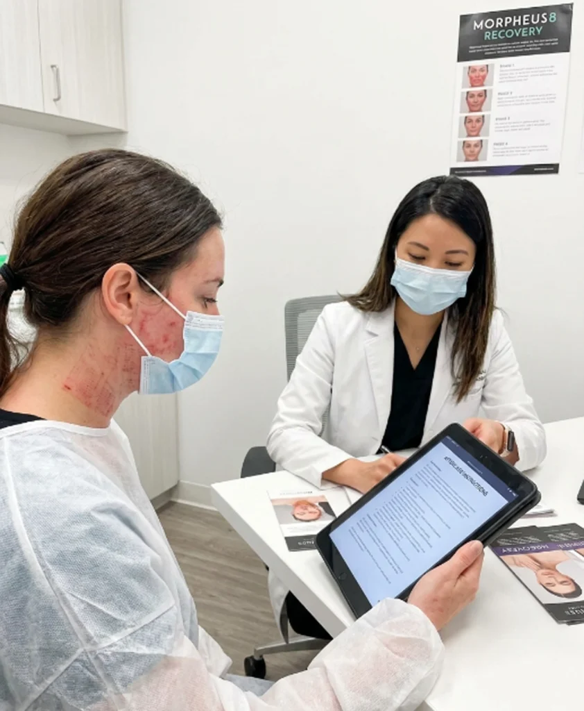 Temporary redness and mild skin irritation during recovery after Morpheus8 treatment