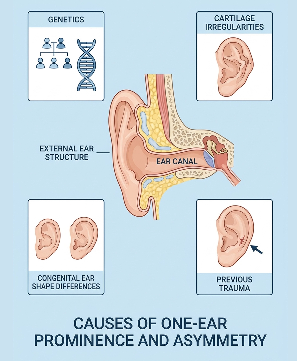 Common causes of one-ear asymmetry and prominence treated with pinnaplasty surgery