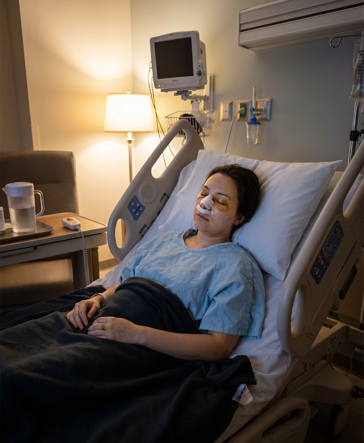 Patient recovering overnight after rhinoplasty surgery while wearing a nasal splint