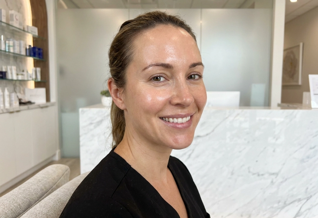 Confident patient after SkinPen treatment with smoother and healthier-looking skin