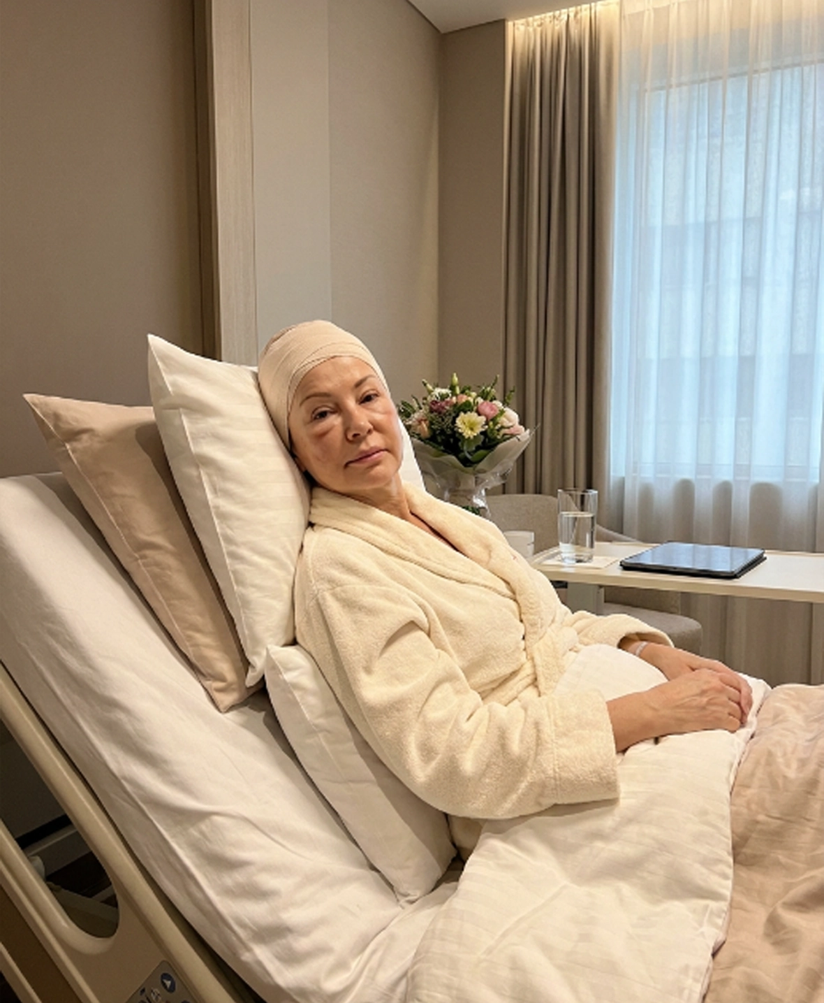 Patient recovering after surgical face lift procedure with mild swelling visible