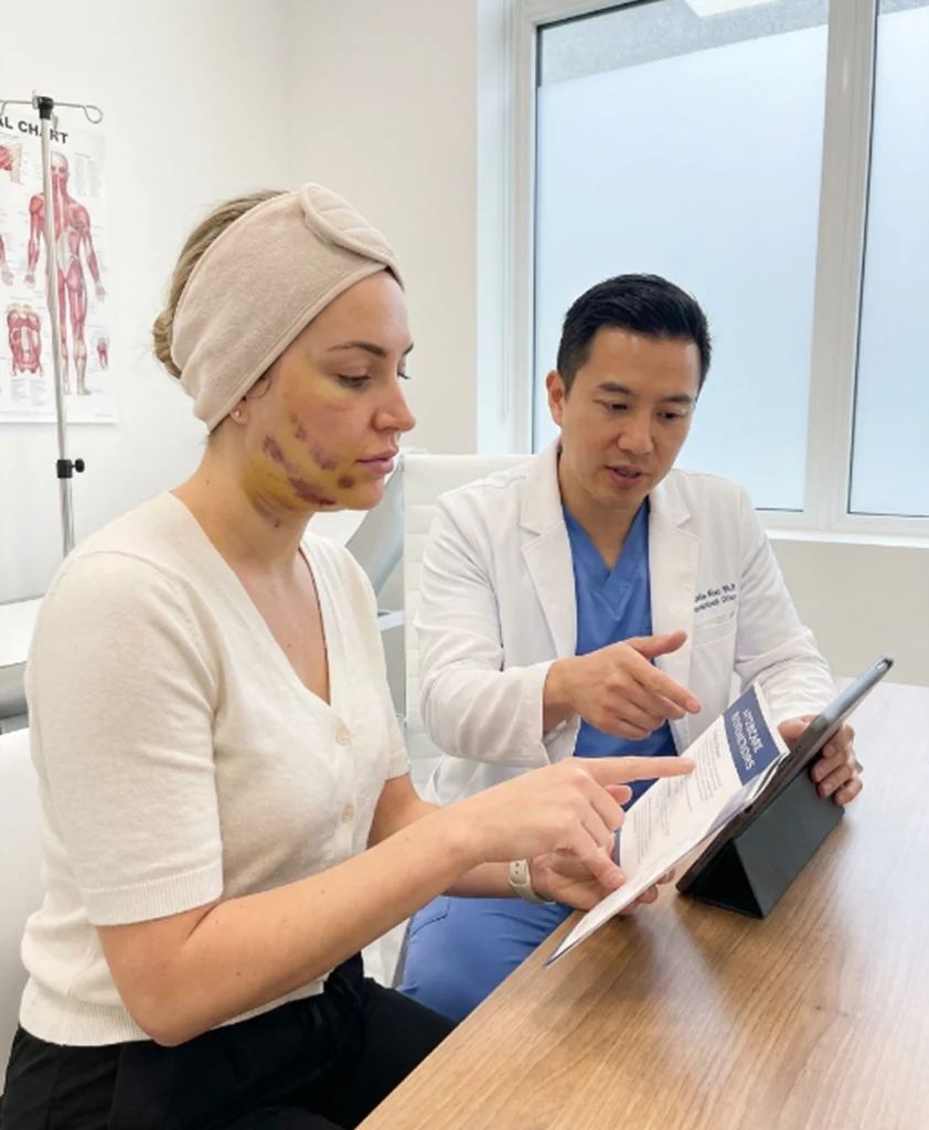 Temporary swelling and bruising during recovery after surgical facelift procedure