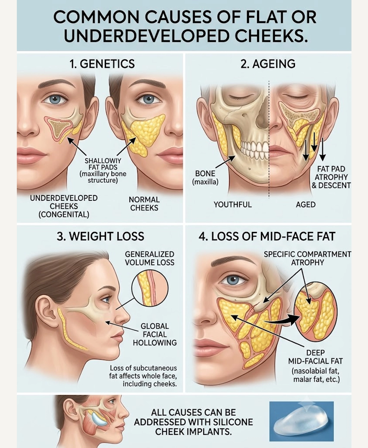 Common causes of flat or underdeveloped cheeks treated with silicone implants