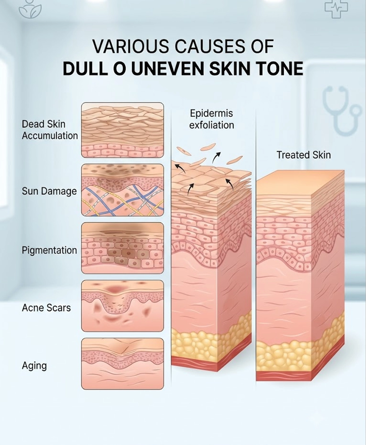 Common causes of dull or uneven skin treated with glycolic peel