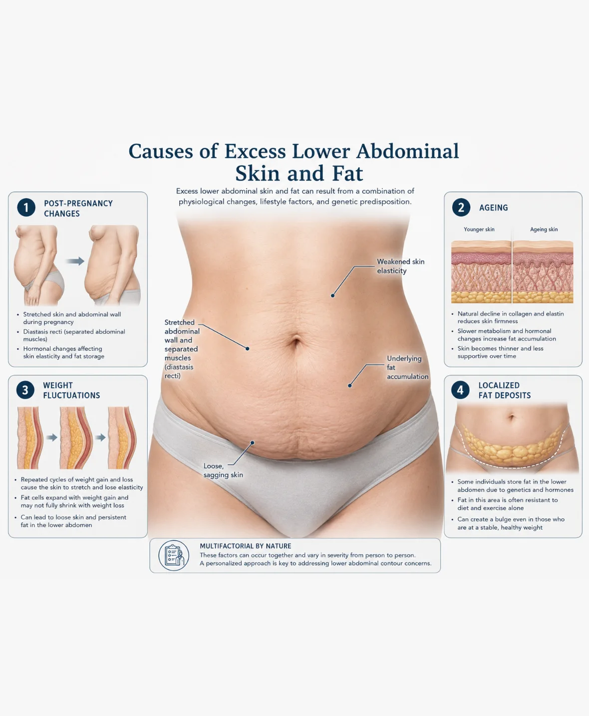 Mini Abdominoplasty Overnight Stay 1180x1435 1